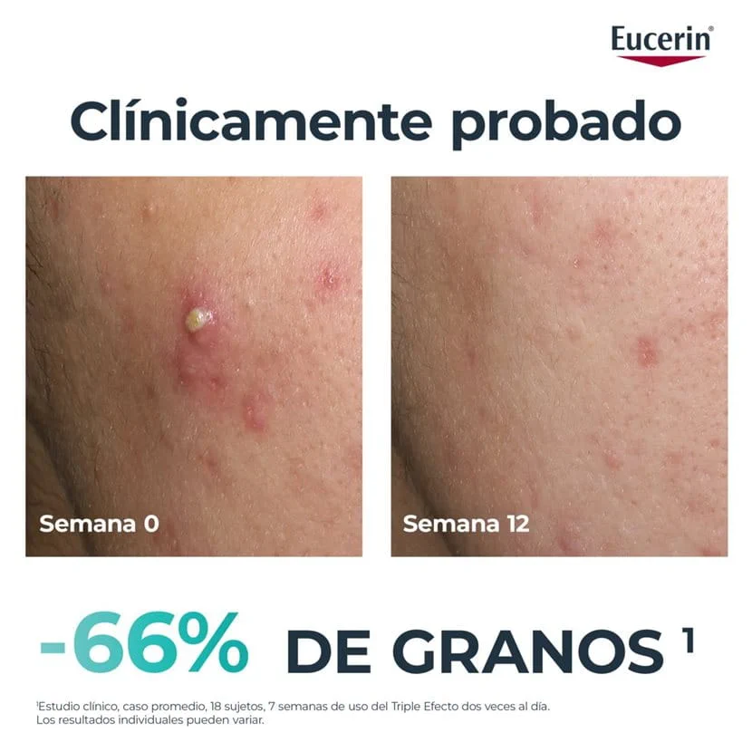EUCERIN SÉRUM TRIPLE ACTION 40ML - Imagen 3