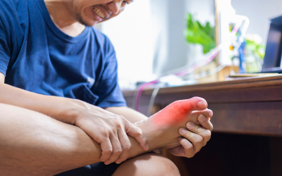 ¿Tienes el ácido úrico alto? Todo lo que debes saber sobre la gota y la alimentación